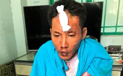 Tức giận vì bị xua đuổi, người đàn ông hất xăng châm lửa đốt 3 mẹ con "người tình" nguy kịch