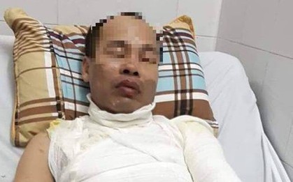 Hà Nội: Đang chở con gái đi trên đường, người đàn ông bị kẻ lạ lao đến tạt a xít