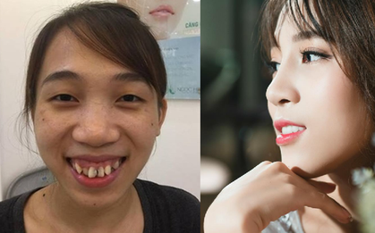 Cuộc sống của những cô gái từng bị chê là "khỉ", "vượn", "Thị Nở" sau khi lột xác ngoạn mục nhờ dao kéo