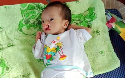 Phép màu đến với bé trai 2 tháng tuổi nặng chỉ 2 ký, mẹ nghèo không đủ tiền đưa con đi chữa bệnh