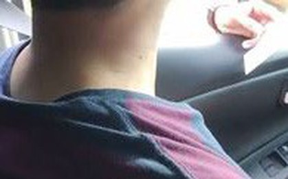 Lãnh đạo BV Nhi nói gì vụ thu phí gửi ô tô 1,7 triệu đồng