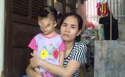 Khát vọng ánh sáng của bé gái 4 tuổi mang gương "mặt quỷ"