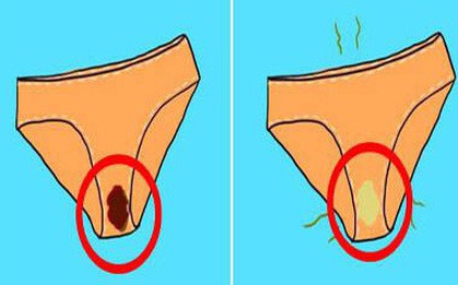 5 vấn đề sức khỏe thường gặp ở vùng kín mà con gái không nên chủ quan bỏ qua