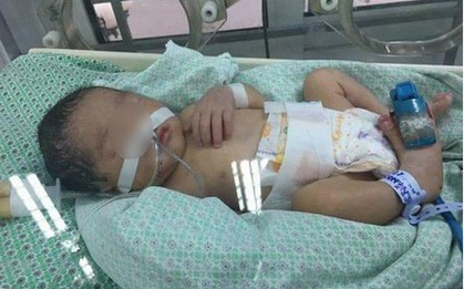 Bé gái 32 tuần tuổi bị mẹ phá thai để chối bỏ được nhóm thiện nguyện khi đi nhặt xác thai nhi cứu sống