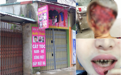 Bọc răng, uốn tóc, cắt mí - Những ca làm đẹp thông thường nhưng đã khiến các nạn nhân "tiền mất tật mang"