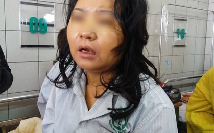 Một phụ nữ nguy kịch, xơ gan nghi do sử dụng thực phẩm chức năng để giảm cân