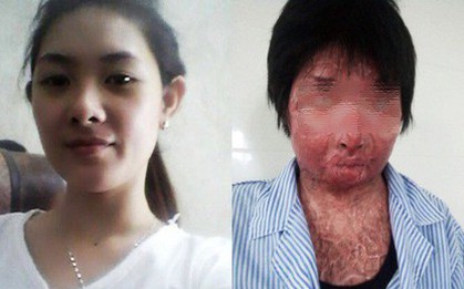 Cuộc sống tươi mới của người phụ nữ xinh đẹp bị chồng tẩm xăng đốt