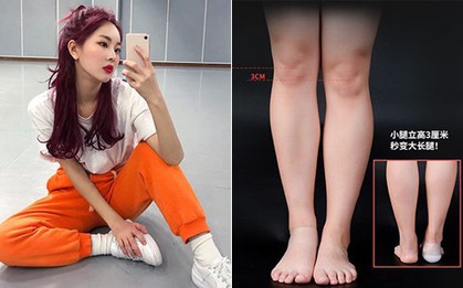Sau giày độn, giờ còn có cả tất độn giúp tăng chiều cao "kín đáo" hơn mà các nàng nên update ngay còn kịp
