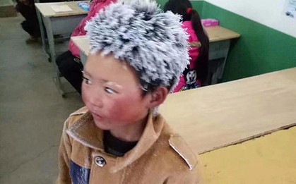Cậu bé "tóc đóng băng" được quyên góp hơn 1 tỷ đồng nhưng chỉ nhận 28 triệu, lý do thực sự sẽ khiến bạn thấy ấm lòng