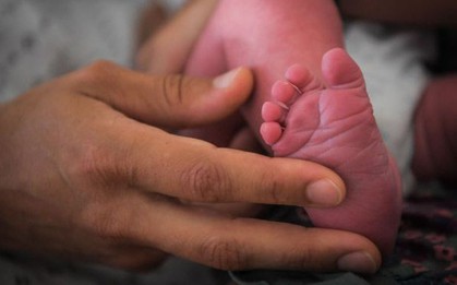 Bí ẩn chuyện hàng loạt trẻ sơ sinh Pháp chào đời không có tay