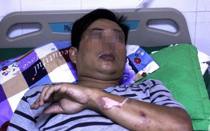 Leo lên cao hàn sắt sửa quán ăn, thanh niên bị điện giật ngưng tim và 5 phút hồi sinh thần kỳ