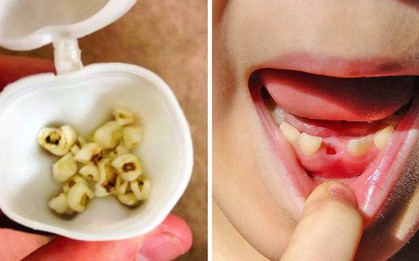 Đánh răng 2 lần/ngày thôi chưa đủ, nha sĩ nào cũng muốn bạn biết những điều này để bảo vệ răng miệng