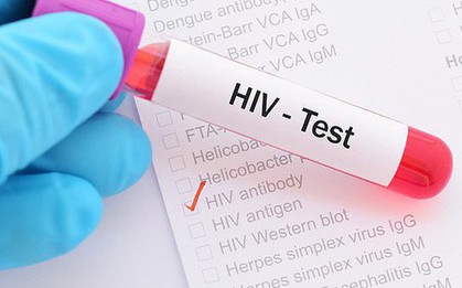 Phát hiện cơ chế giúp chữa khỏi HIV ngay trong não người