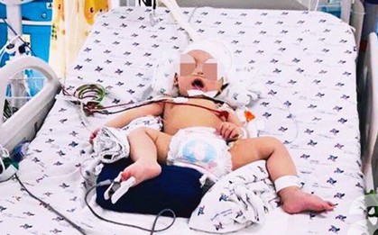 TP.HCM: Bé 8 tháng tuổi phải đón Noel trong viện, xuất huyết não nguy kịch vì tai nạn lúc sinh hoạt