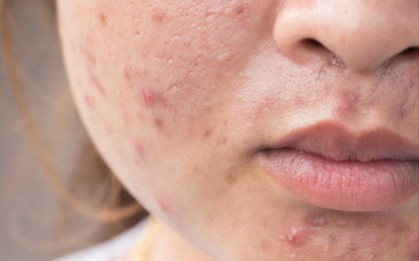 Không khí Hà Nội những ngày giáp Tết chạm mức nguy hại: nếu không đeo khẩu trang khi ra đường là bạn sẽ lĩnh đủ hậu quả
