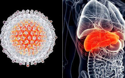5 căn bệnh ung thư dễ mắc nhất ở cả 2 giới tại Việt Nam hiện nay, hãy phòng tránh ngay từ bây giờ