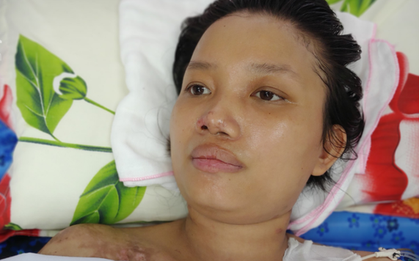 Mẹ mới sinh phải cắt cụt tứ chi sau khi bị áp xe vú: Bác sĩ sản khoa tiết lộ thông tin bất ngờ