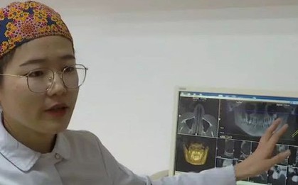 Mới 28 tuổi đã rụng răng như bà lão, cô gái Trung Quốc bất ngờ vì căn bệnh tiềm ẩn đằng sau đó
