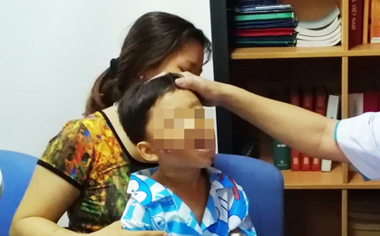 Thương tâm: Mẹ chở con không đội nón bảo hiểm, nhiều trẻ bị tai nạn cực nặng đến biến dạng mặt