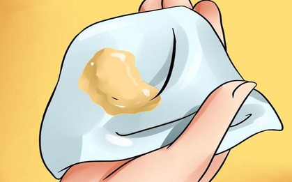 Thấy vùng kín nổi u cục, cô gái 29 tuổi không ngờ đó là dấu hiệu của bệnh ung thư âm đạo