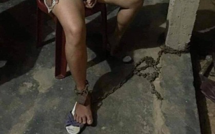 Gã chồng say rượu xích vợ vào cột nhà, dùng búa đánh vào đầu bị xử phạt, đưa vào diện quản lý