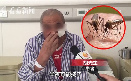 Nhiều người thường làm điều này khi bị muỗi đốt nhưng một người đàn ông ở Trung Quốc đã bị hoại tử xương vì làm vậy