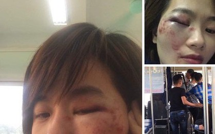 Vụ nữ nhân viên xe buýt bị nhóm thanh niên hành hung: 4 thanh niên đều say rượu