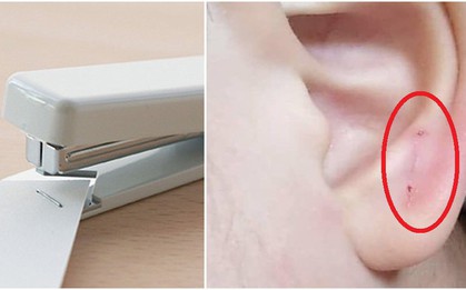Cậu bé 4 tuổi bị giáo viên dập ghim vào tai, phản ứng của hiệu trưởng khiến người người, nhà nhà phẫn nộ