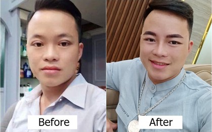 Chồng cô dâu 62 tuổi tiếp tục được vợ đưa đi phẫu thuật thẩm mỹ, diện mạo mới khiến nhiều người bất ngờ