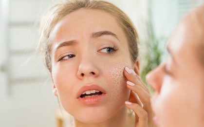 4 thói quen đơn giản giúp cho da không bị khô và nứt nẻ vào mùa lạnh