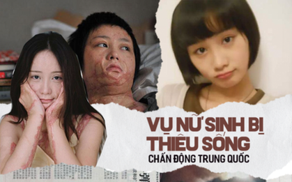 “Cả gan" cự tuyệt tình cảm của đại thiếu gia, nữ sinh xinh đẹp bị thiêu sống, hủy hoại cuộc đời, hung thủ lãnh án nhẹ nhàng nhờ gia thế khủng