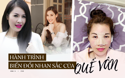 Hành trình "đại trùng tu" tiền tỷ của Quế Vân: Thay 24 bộ răng vẫn chưa ưng, làm mũi 6 lần vì mong được như Song Hye Kyo