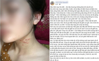 Người phụ nữ nghi bị chồng đánh đập kêu cứu cộng đồng mạng: "Xin ai đó hãy báo công an giúp"