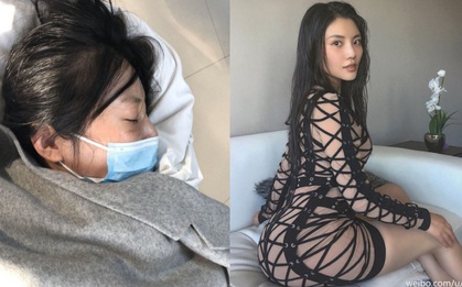 "Kim Kardashian Trung Quốc" nhập viện gấp vì tình trạng nguy kịch nhưng cớ sao lại bị Cnet chỉ trích, nghi ngờ?