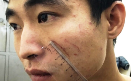 Sát hại nữ sinh viên 18 tuổi trong cơn phê ma túy đá ở nhà nghỉ