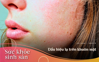 Bạn sẽ ít nghĩ mình có thể đang mắc bệnh phụ khoa khi thấy một trong những triệu chứng sau trên khuôn mặt