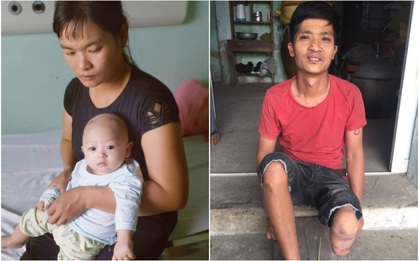 Xót xa gia cảnh của người phụ nữ trầm cảm sau sinh, chồng cụt chân, con gái 6 tháng tuổi mắc ung thư, con trai thiểu năng trí tuệ