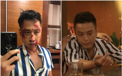 Bảo tuần lộc mặc áo đôi với Hùng trợ lí ở Hoa Hồng Trên Ngực Trái nhưng sao cùng một style lại 2 số phận thế này!