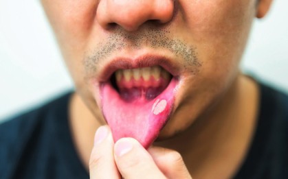 Đây là những triệu chứng cảnh báo ung thư sớm mà con trai không nên chủ quan bỏ qua