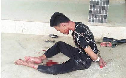 Vụ chồng sát hại vợ rồi ôm xác suốt nhiều giờ: Cảm giác có người muốn giết mình nên siết cổ vợ?