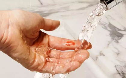 Tết đến nấu nướng, làm cỗ có lỡ đứt tay thì hãy nhớ ngay những bước sơ cứu này