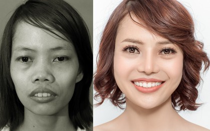 Đẹp tự nhiên hay nhân tạo không quan trọng, quan trọng là bạn hạnh phúc