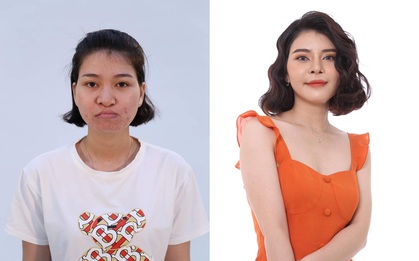 Hở hàm ếch bẩm sinh và kết quả sau thẩm mỹ vượt mong đợi của bác sĩ, mẹ đẻ òa khóc, hàng xóm không nhận ra