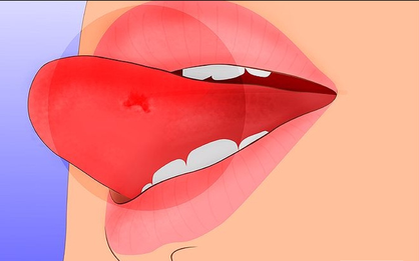 Nhiều người thường hay gặp phải tình trạng này nhưng không biết nó có thể cảnh báo những vấn đề sức khỏe đáng lo ngại