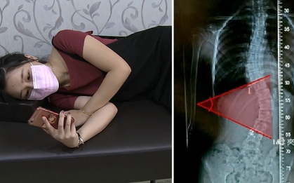 Hành động mà giới trẻ thường làm mỗi ngày nếu không sửa ngay có nguy cơ cao gây hỏng cột sống vĩnh viễn