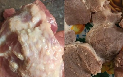 Ai cũng lo sợ trước bệnh sán lợn hoành hành nhưng thực tế thì mức độ nguy hiểm của nó đến đâu?