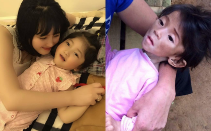 Hình ảnh mới nhất cho thấy em bé Lào Cai bụ bẫm, được mẹ nuôi cưng nựng hết mực khiến nhiều người xúc động