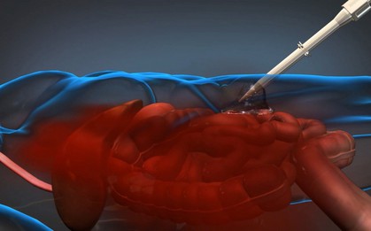 Cẩn thận với những triệu chứng cảnh báo tình trạng chảy máu trong mà bạn không ngờ đến