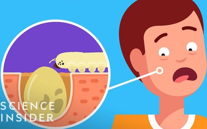 Bạn có tin trên mặt mình lúc này đang có tới hàng nghìn con bọ đang lúc nhúc giao phối và đẻ trứng?