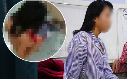 Nữ sinh bị lột đồ đánh hội đồng vẫn đang trong tình trạng hoảng loạn, thường xuyên ôm đầu la hét